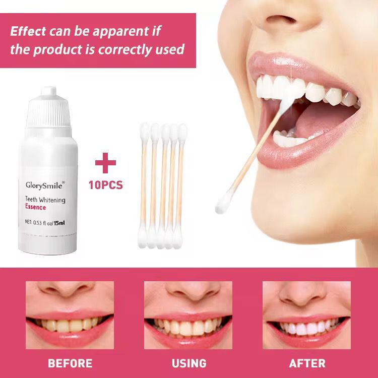 Kit blanchiment dentaire GlorySmile 15ml